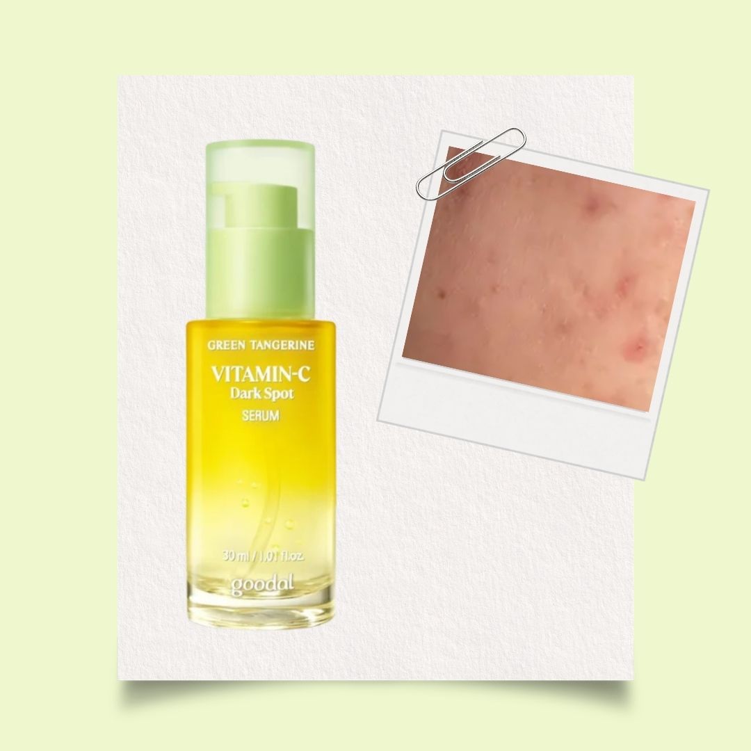 Best Korean Serums for Dark Spots in Canada (2026 Guide) vgle beauty