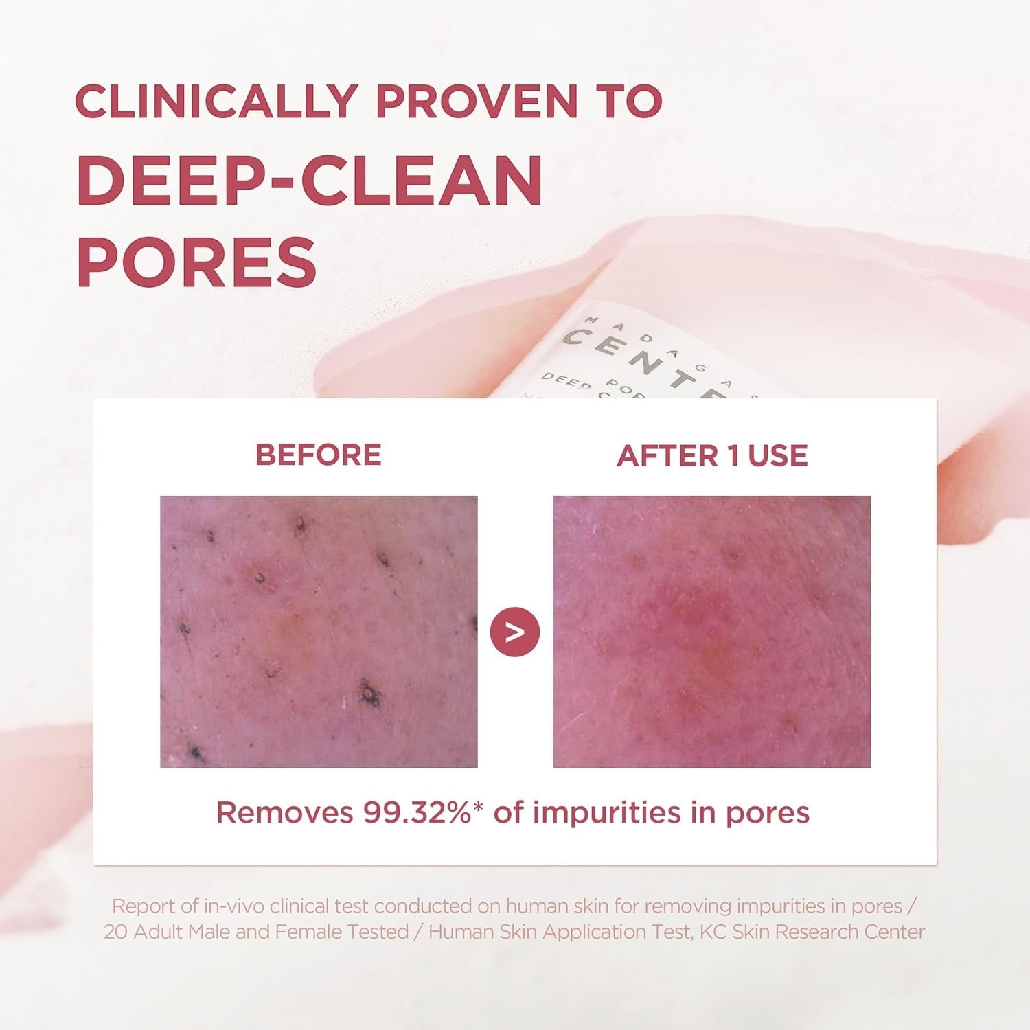 SKIN1004 Centella Poremizing Deep Cleansing Foam 125ml | VGLE Beauty Canada