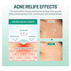 SOME BY ME 30 Days Miracle Clear Spot Patch | VGLE Beauty Canada