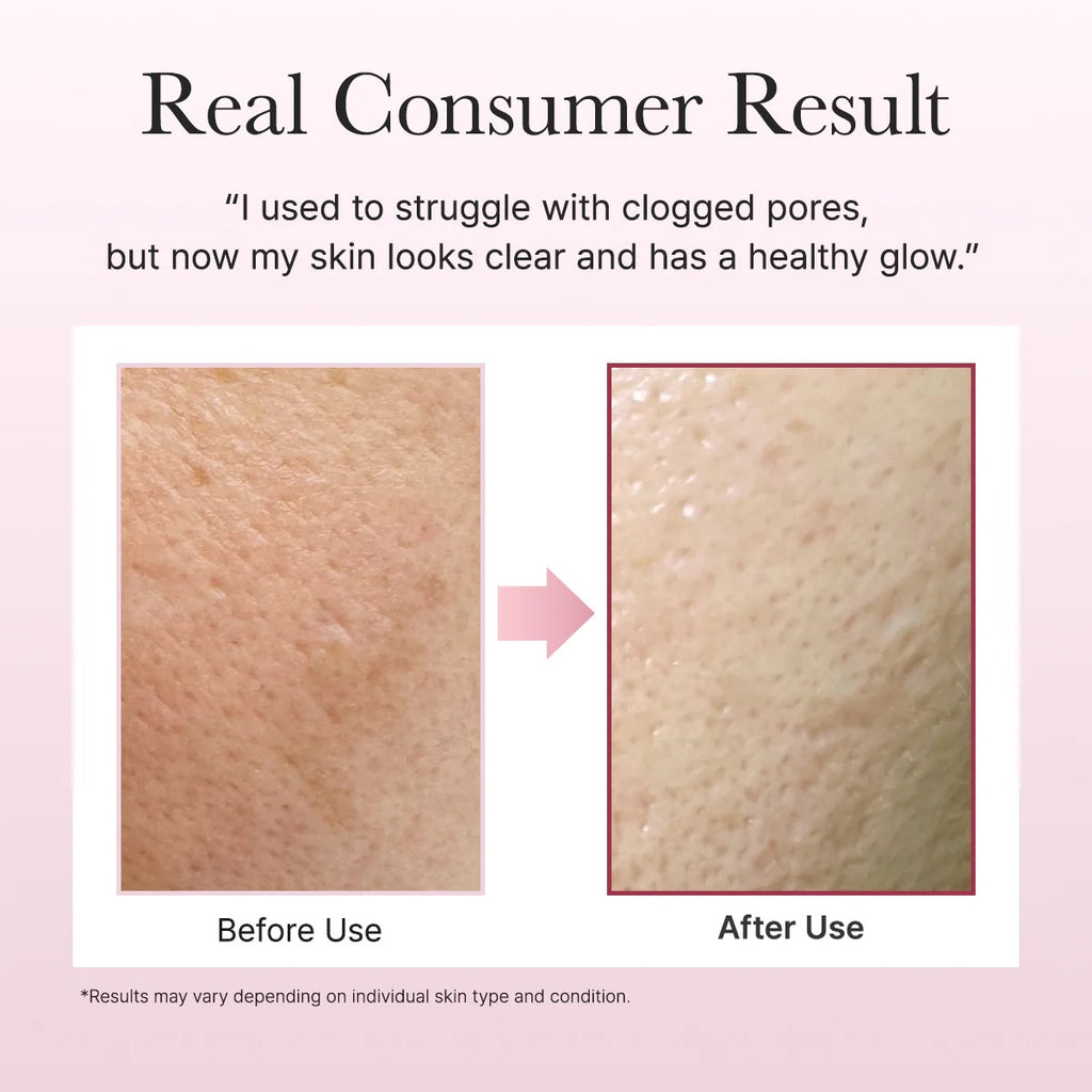 Arencia Fresh Rosehip Rice Mochi Cleanser | VGLE Beauty Canada