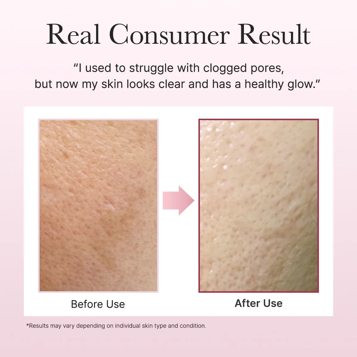 Arencia Fresh Rosehip Rice Mochi Cleanser | VGLE Beauty Canada