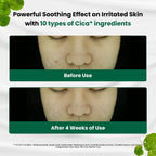 Dr.G R.E.D Blemish Clear Soothing Cream 70ml Dr.G R.E.D