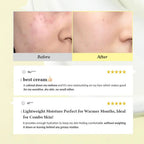 Dr. Althea 345 Relief Cream 50ml – Skin Care | Korean Skincare Canada - VGLE Beauty, buy dr althea 345 relief cream Canada