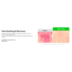 EQQUALBERRY Aloe PDRN Calming Serum 30ml