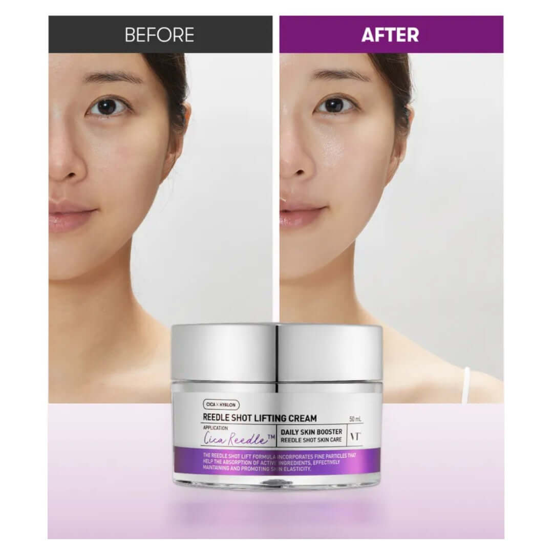 VT Cosmetics Reedle Shot Lifting Cream 50ml – VGLE Beauty