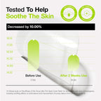 Anua Ultra Thin Spot Cover Patch 75ea | VGLE Beauty Canada