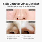 celimax Ji Woo Gae Heartleaf BHA Peeling Pad 125ml / 60pads – Skin Care | Korean Skincare Canada - VGLE Beauty