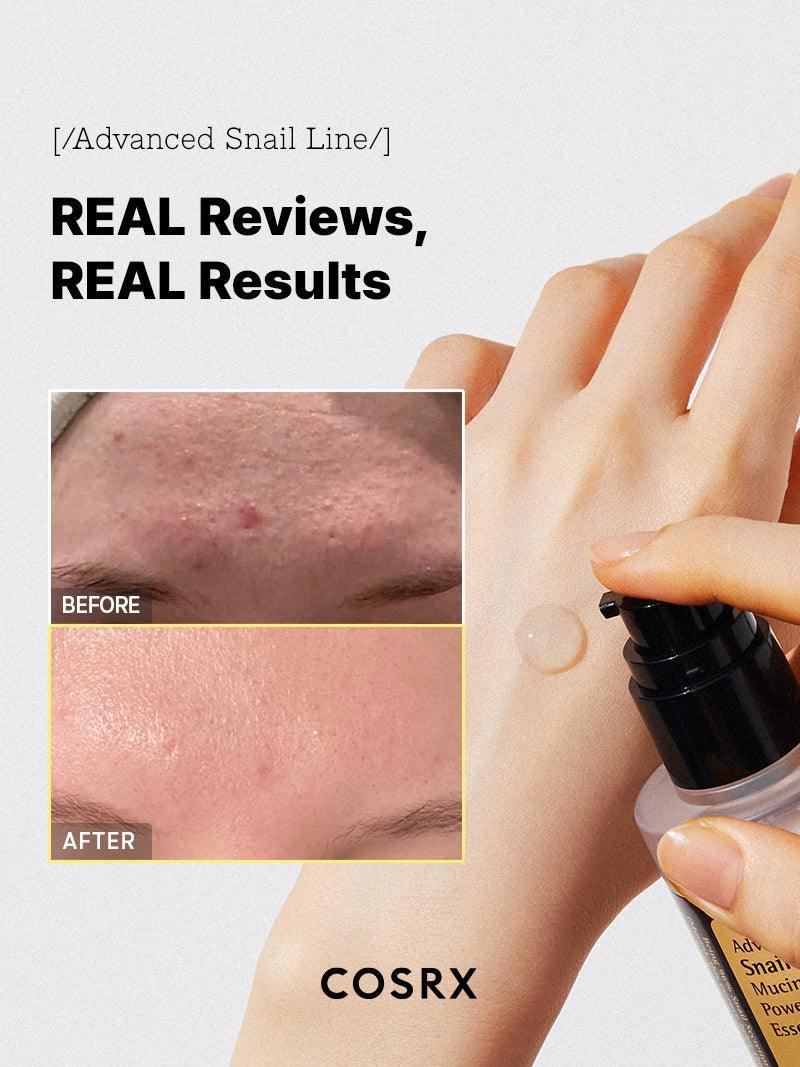 COSRX - Advanced Snail 96 Mucin Power Essence – 100ml – Skin Care | Korean Skincare Canada - VGLE Beauty