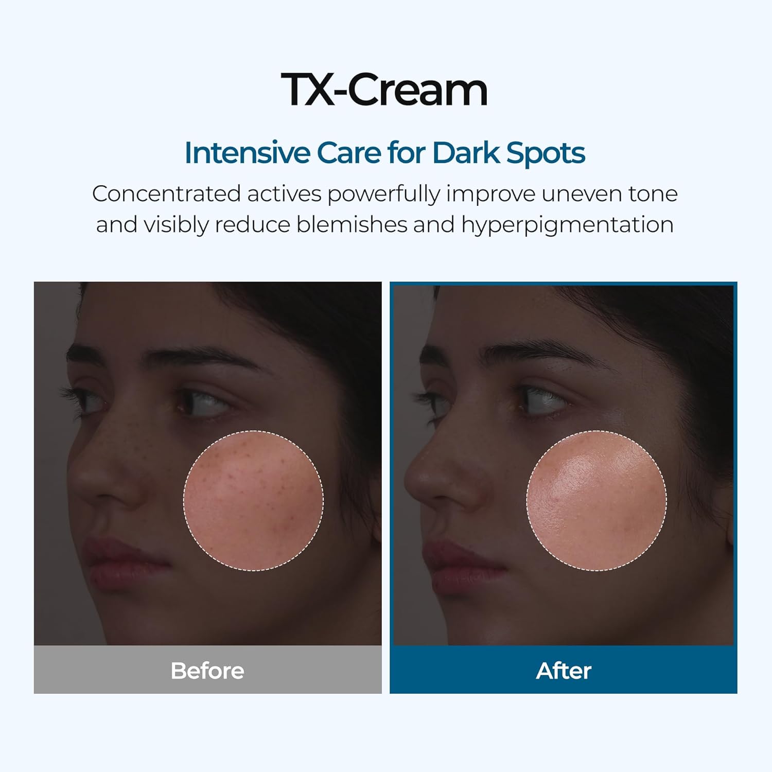 Dr.Melaxin TX Cream 50ml | VGLE Beauty Canada