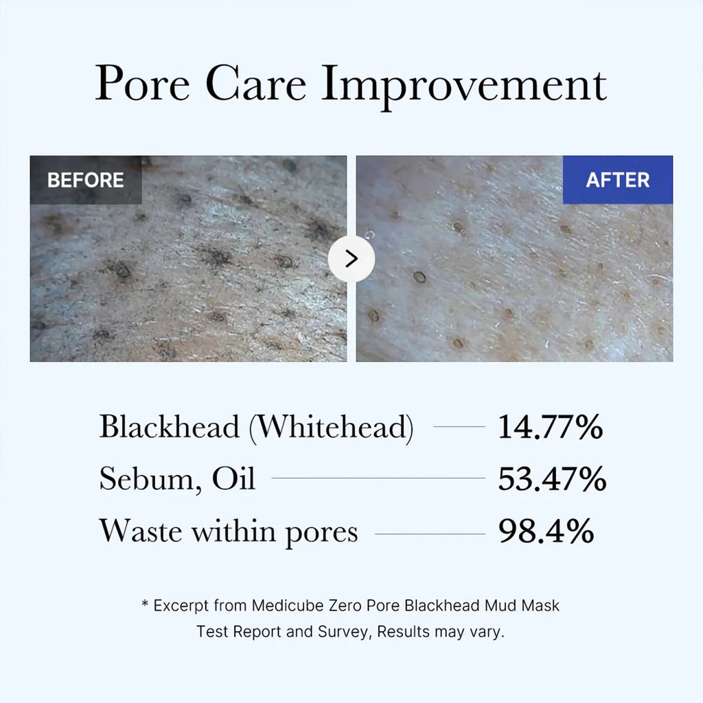medicube Zero Pore Blackhead Mud Mask VGLE Studios