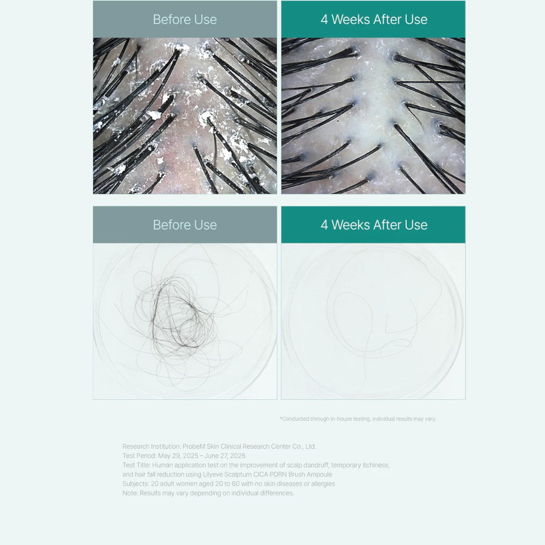 Lilyeve Scalp Turn Cica PDRN Brush Ampoule