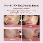 medicube PDRN Pink Peptide Serum, Pink glow serum, Peptide, Niacinamide, Hydrating & Moisturizing & Firming, Uneven Skin Tone, Korean Skincare