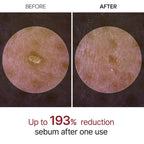 Dr.Melaxin White Rice Exfoliating Ampoule 80ml | VGLE Beauty Canada